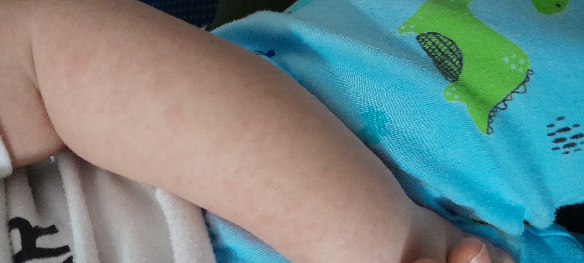 خروپف و کیپ بودن بینی خروپف و کیپ بودن بینی