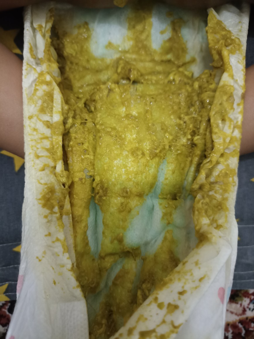 نحوه دتدن آزیترو....ب بچه ۹ماهه😐 نحوه دتدن آزیترو....ب بچه ۹ماهه😐