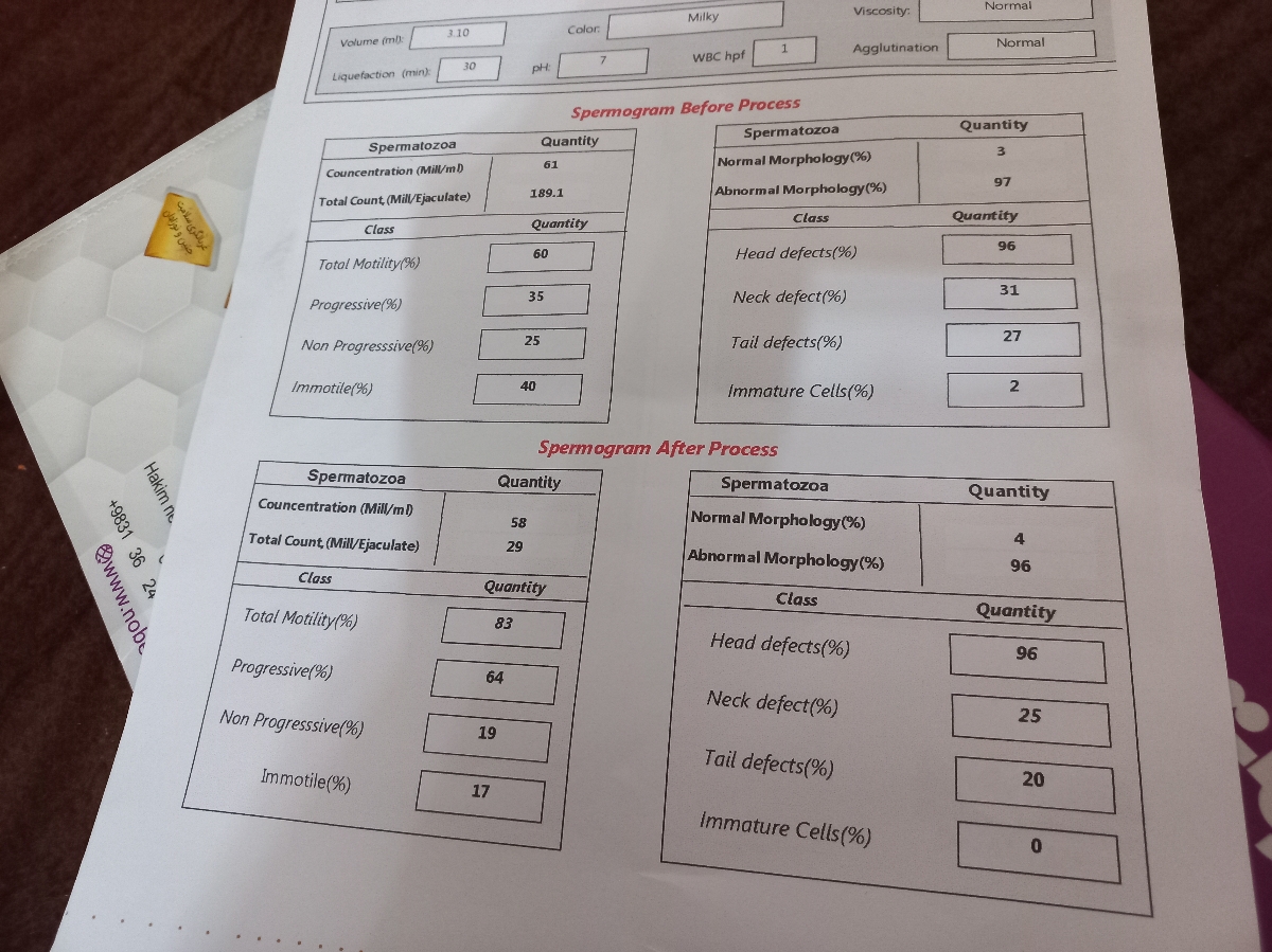 آیا با این آزمایش امکان بارداری هست