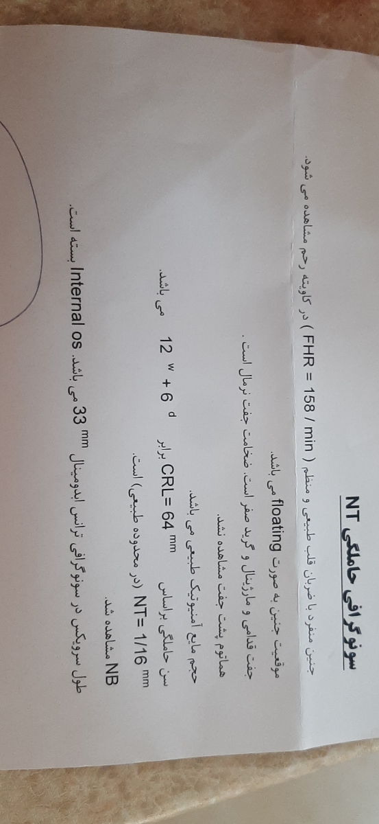 تفسیر سونو nt،تعیین جنسیت؟ تفسیر سونو nt،تعیین جنسیت؟