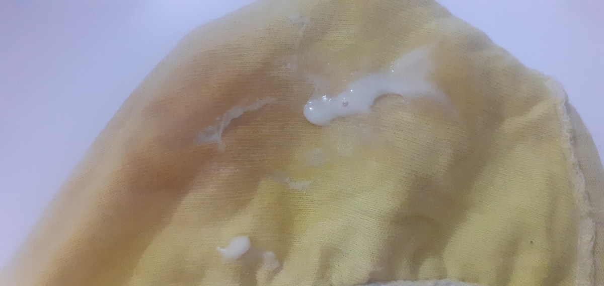 ازصب خیلی درد دارم زیرشکمم سرپابودم یهو خیس شدم ترشح اومد کلی