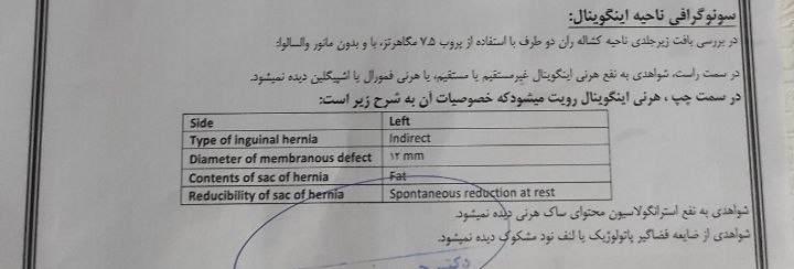 فتق اینگوینال و نوع زایمان