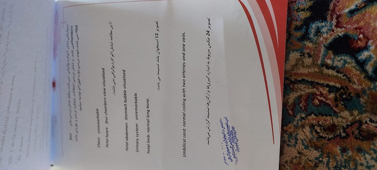 سونو آنومالی نرمال چه خصوصیاتی دارد