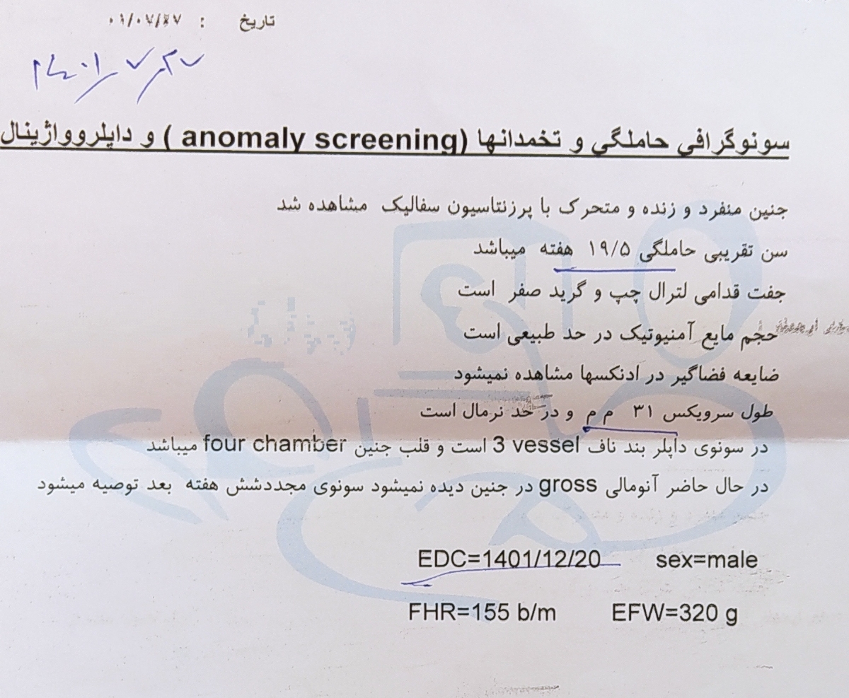 درد خفیف شکم موقع نشستن و سرپا موندن یا پیاده روری در بارداری