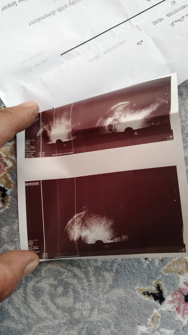 فوری لطفا تفسییر جواب نمونه برداری از رحم