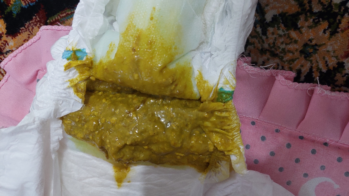 مدفوع بچه ۴ ماهه+عکس مدفوع بچه ۴ ماهه+عکس