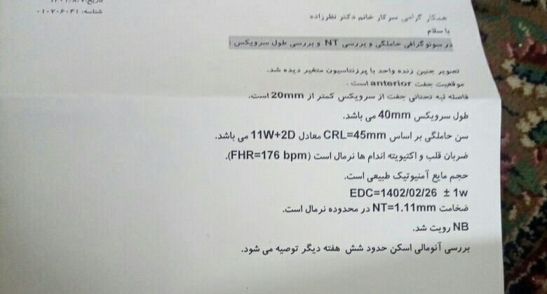 تفسیر سونوی ان تی و جنسیت نی نی چیه