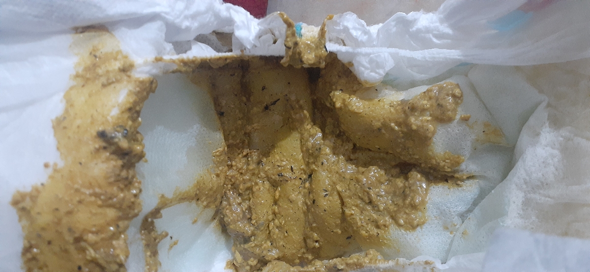 عکس مدفوع نوزاد بدتون میاد نیاید عکس مدفوع نوزاد بدتون میاد نیاید