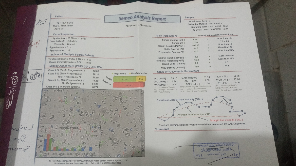 آزمایش اسپرم آزمایش اسپرم