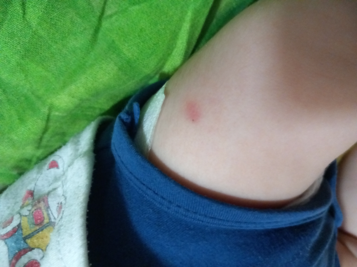 دمای بدن بعد واکسن دوماهگی دمای بدن بعد واکسن دوماهگی