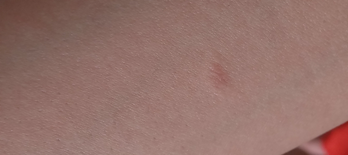 این دستمه این دستمه