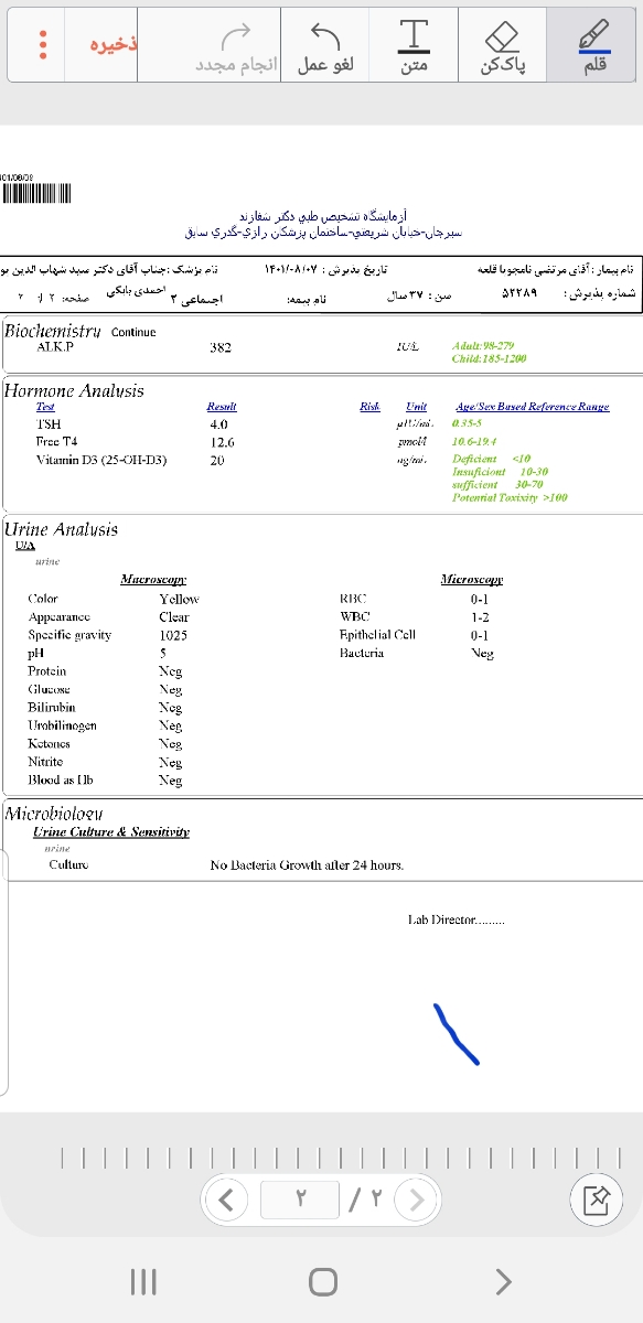 تفسیر آزمایش و آیا آزمایش کاملی است؟