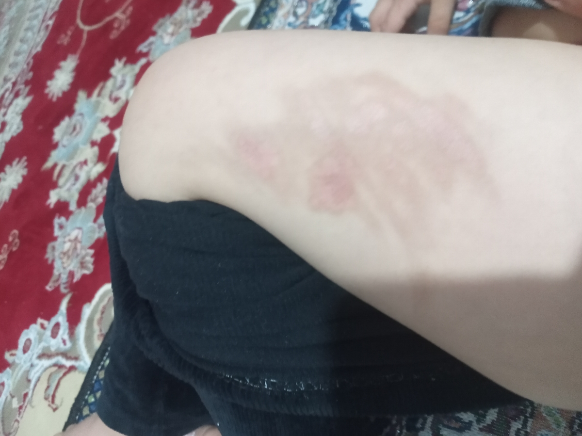 اینم بعد ازیکماهه