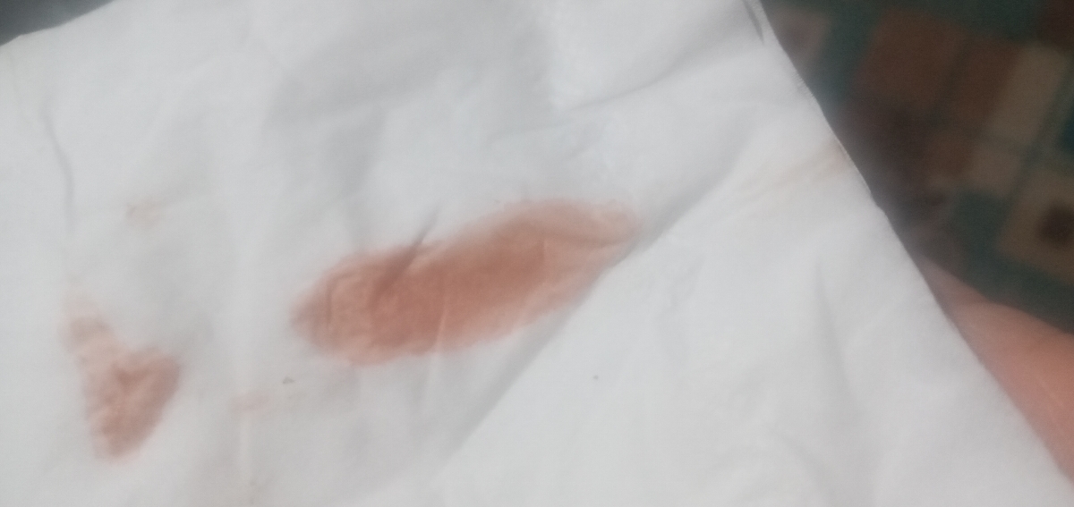 مال منم دیشب این شکلی بود مال منم دیشب این شکلی بود