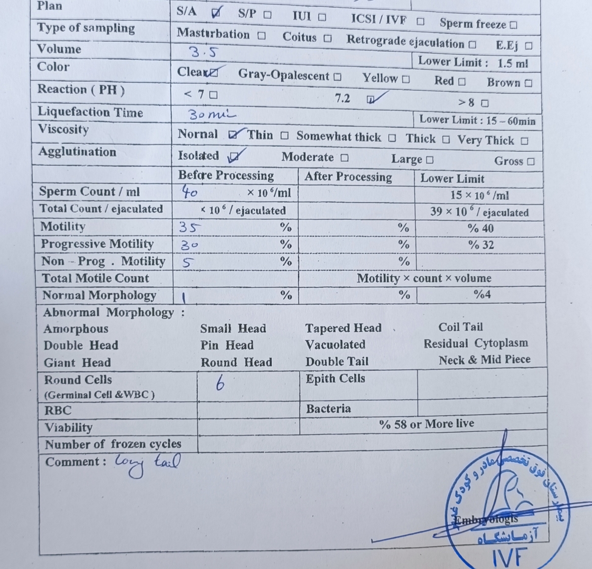 آزمایش آنالیز اسپرم وضعیتش چطوره