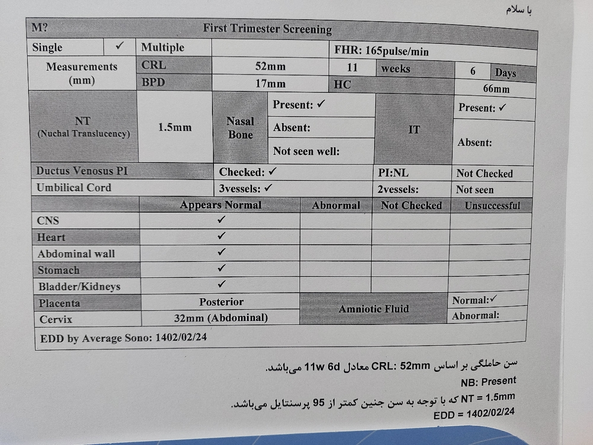 سونو انتی منو لطفا تفسیر کنین؟