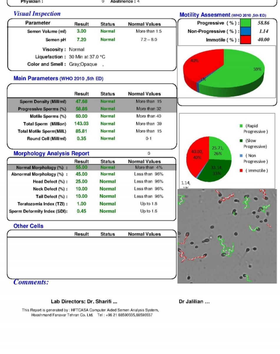 تفسیر آزمایش اسپرم