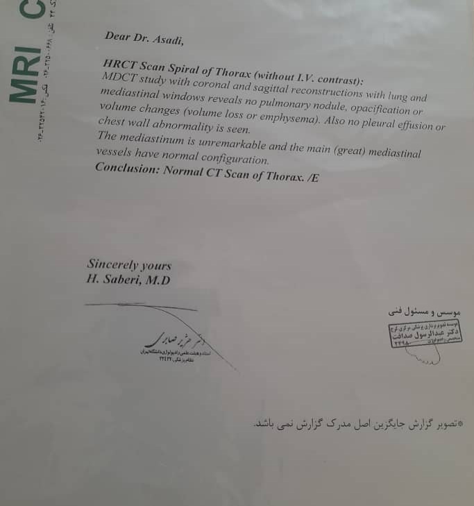 سرفه های مکرر بعد کرونا