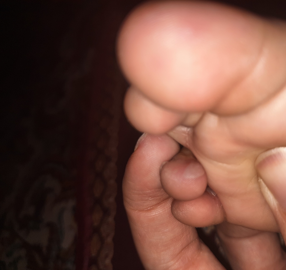 نگرانم😔تاول و دونه روی پای دخترم نگرانم😔تاول و دونه روی پای دخترم