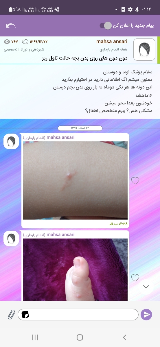 نگرانم😔تاول و دونه روی پای دخترم نگرانم😔تاول و دونه روی پای دخترم