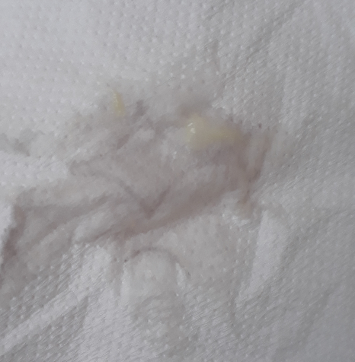 استفاده از شیاف پروژسترون در هفته های اول بارداری مشکلی ایجاد نمیکنه؟