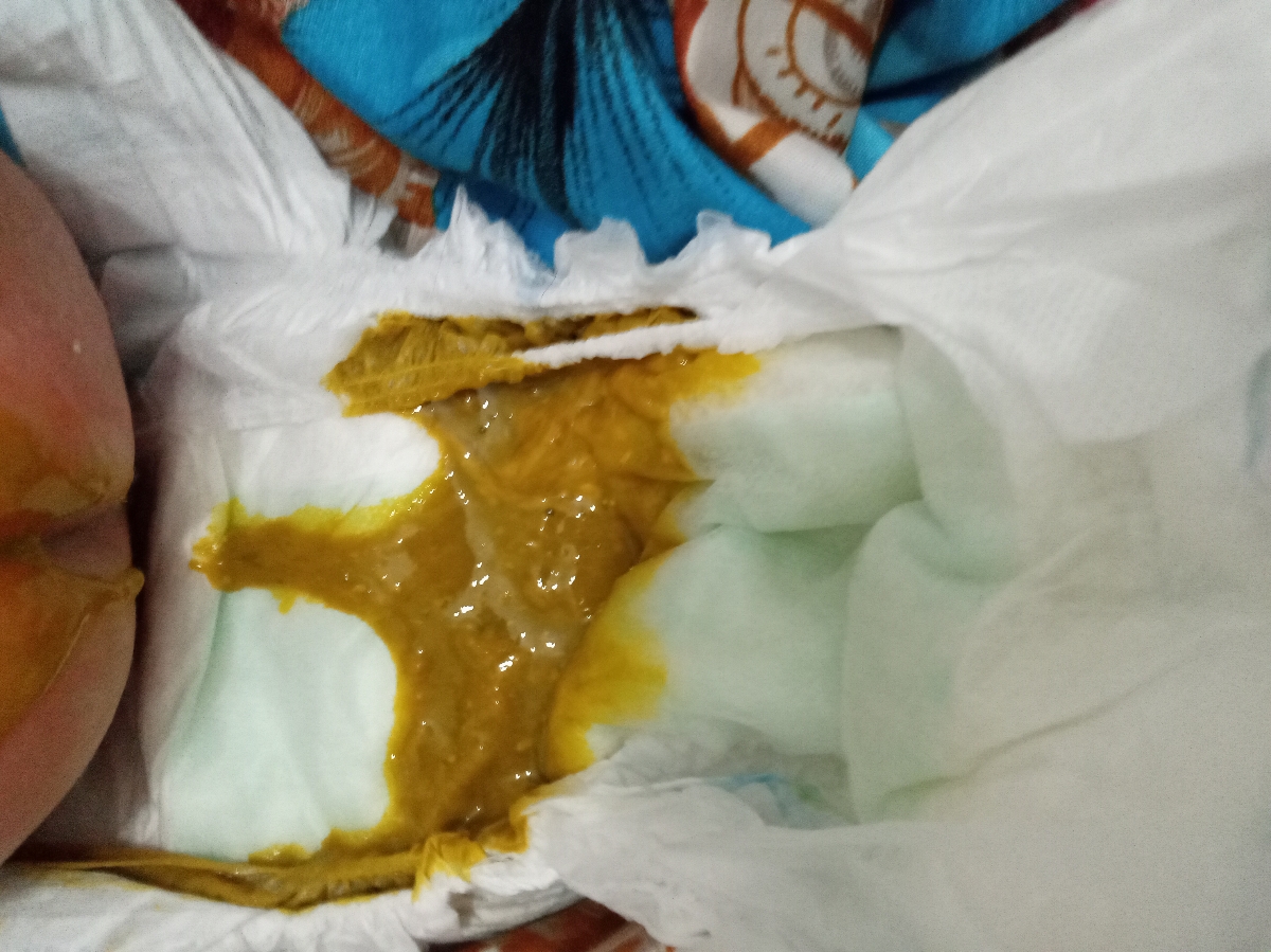 اینم‌عکس‌پی‌پیش