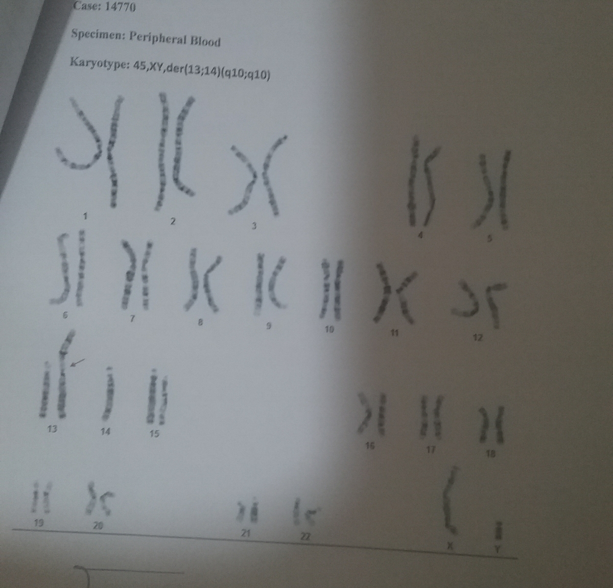 کاریوتایپ همسرم(پدر) کاریوتایپ همسرم(پدر)