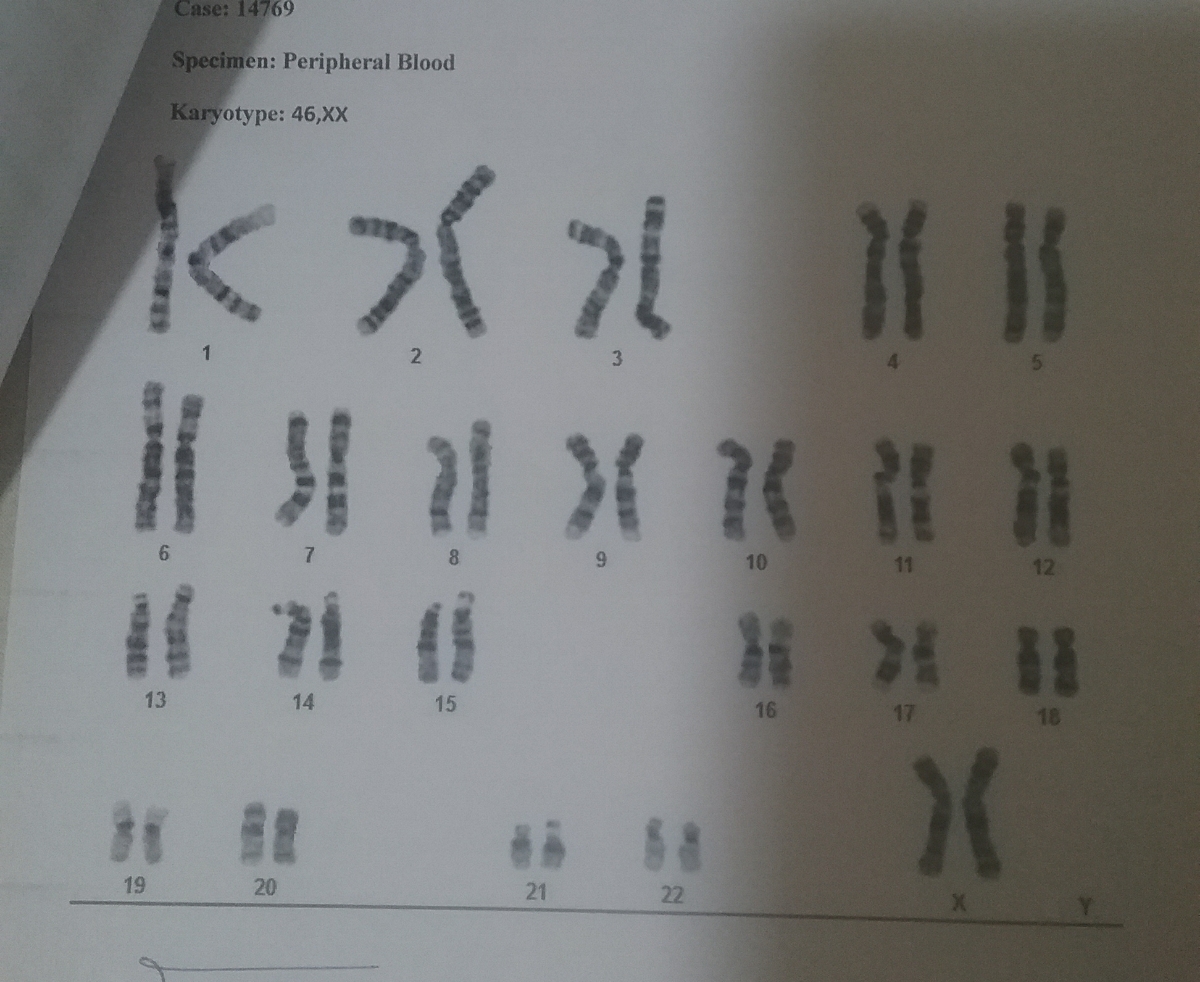 کاریوتایپ خودم (امادر) کاریوتایپ خودم (امادر)