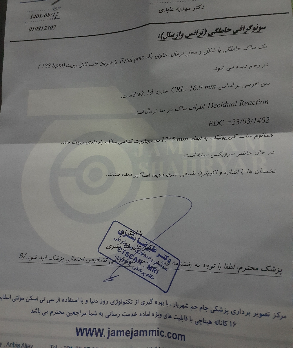 ضربان بالا وهماتوم ۱۷ میلی متری