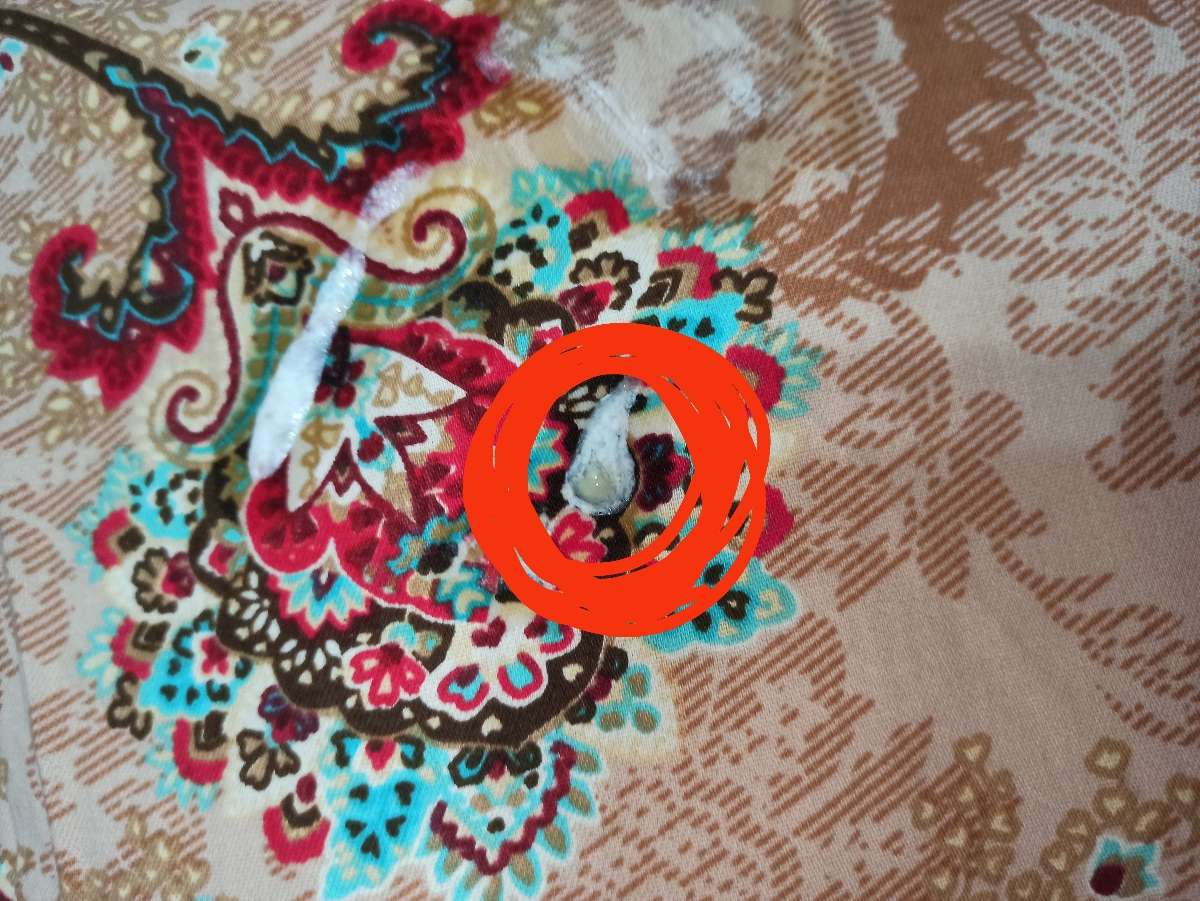 کم اشتهایی شیرخوار