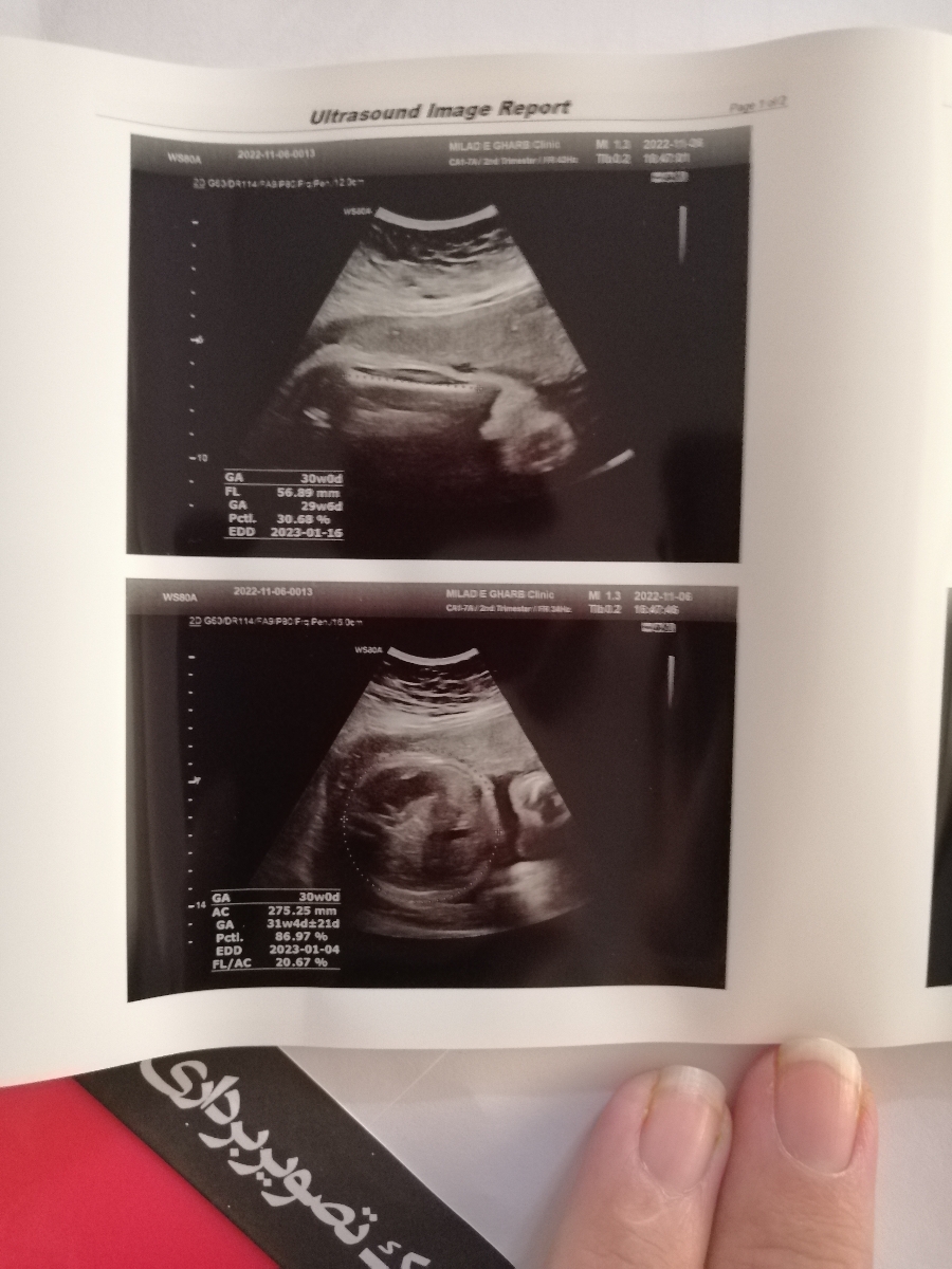 تاریخ زایمان چندم میشه؟