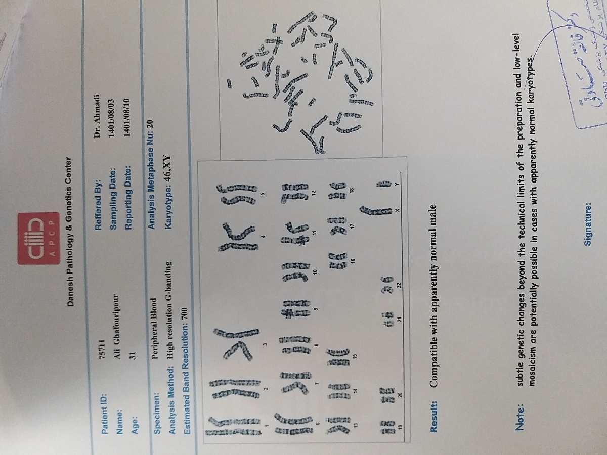 ازمایش کاریوتایپ لطفا تفسیر کنید