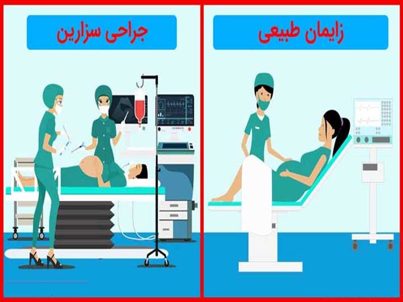سزارین یا طببعی کدوم بهتره؟