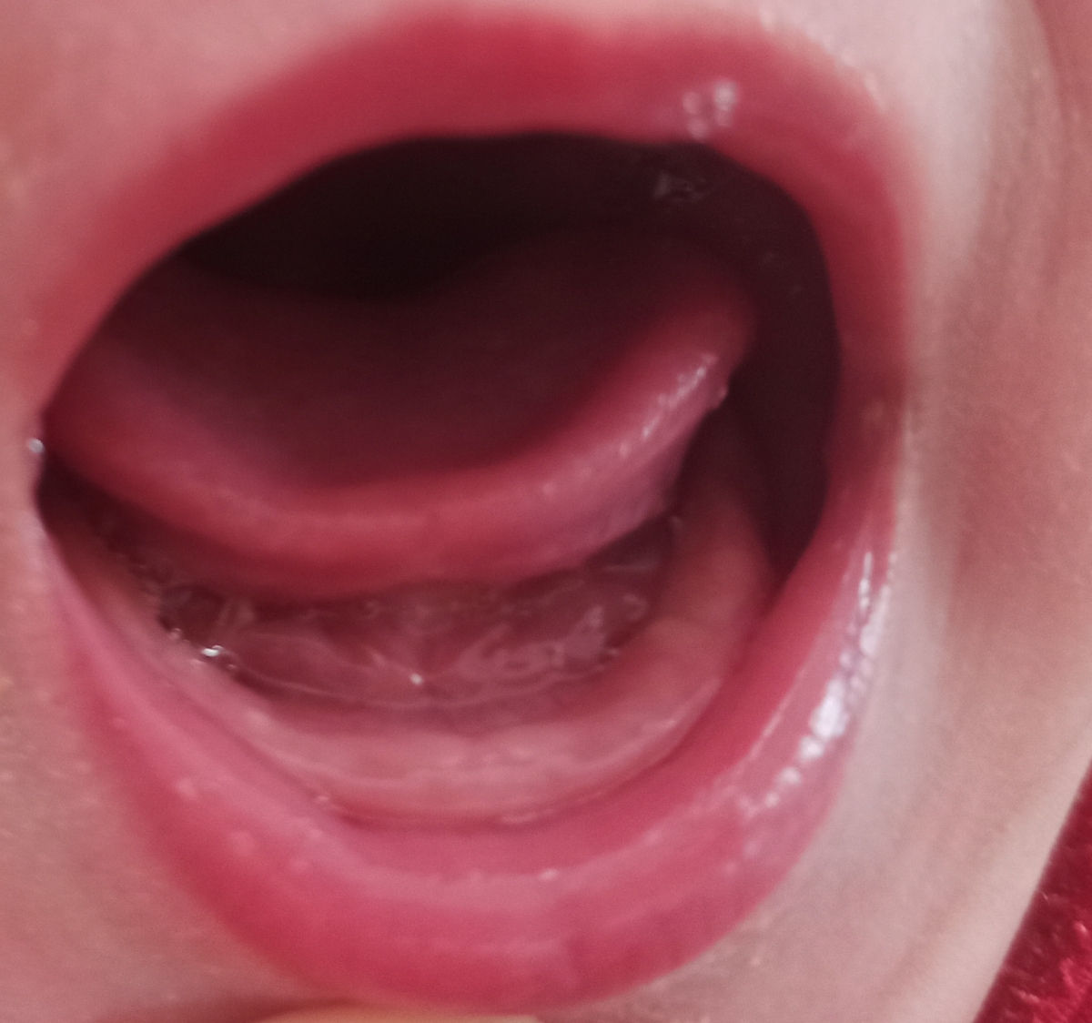 چنتادونه جوش مانندروی لثه اش هس یکم سرش سفیده