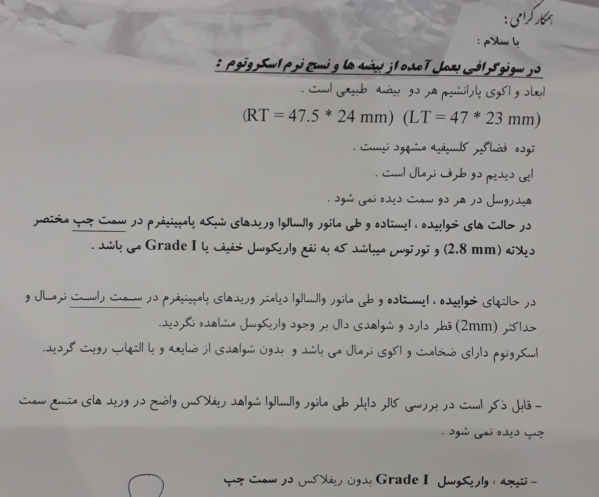 تفسیر سونو بیضه برای واریکوسل