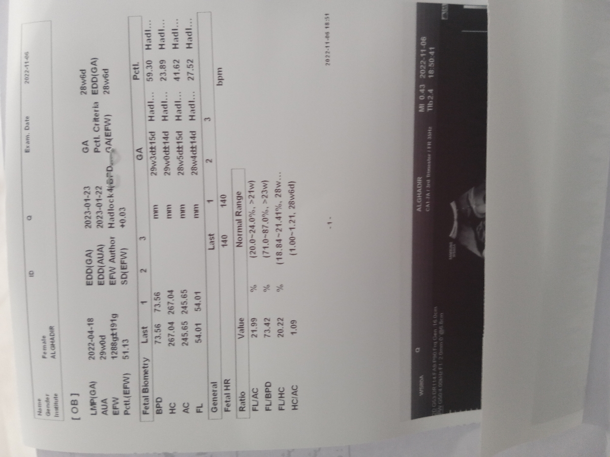 تفسیر سونو گرافی هفت ماهگی