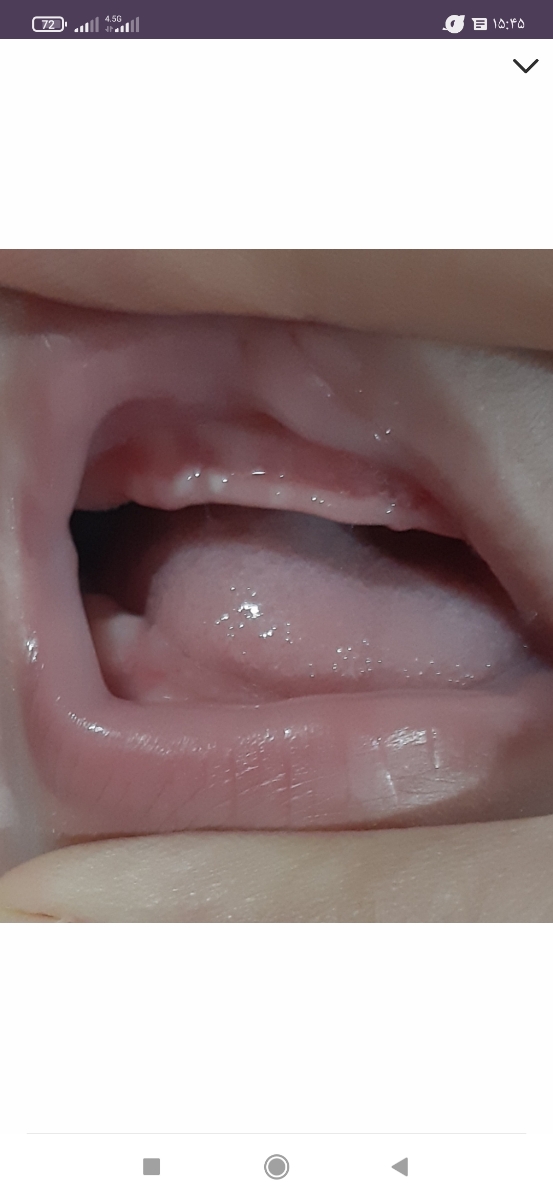 اینجورماننده دونه های سرسفید