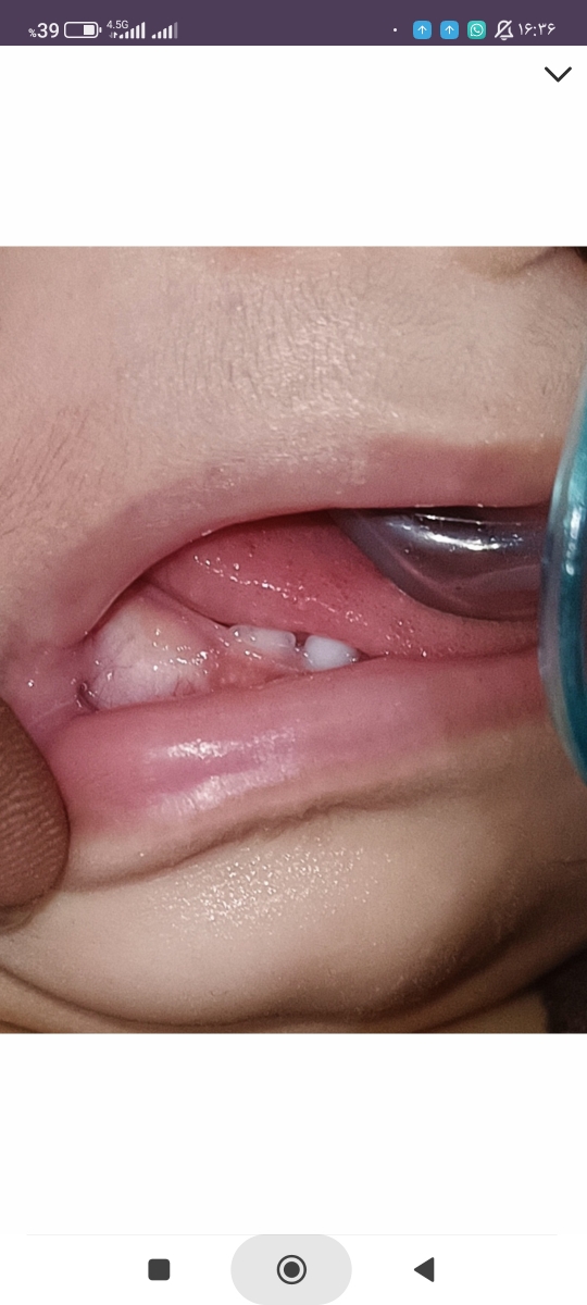 خانوما وپزشک محترم چیکار کنم بچم آروم بشه خانوما وپزشک محترم چیکار کنم بچم آروم بشه