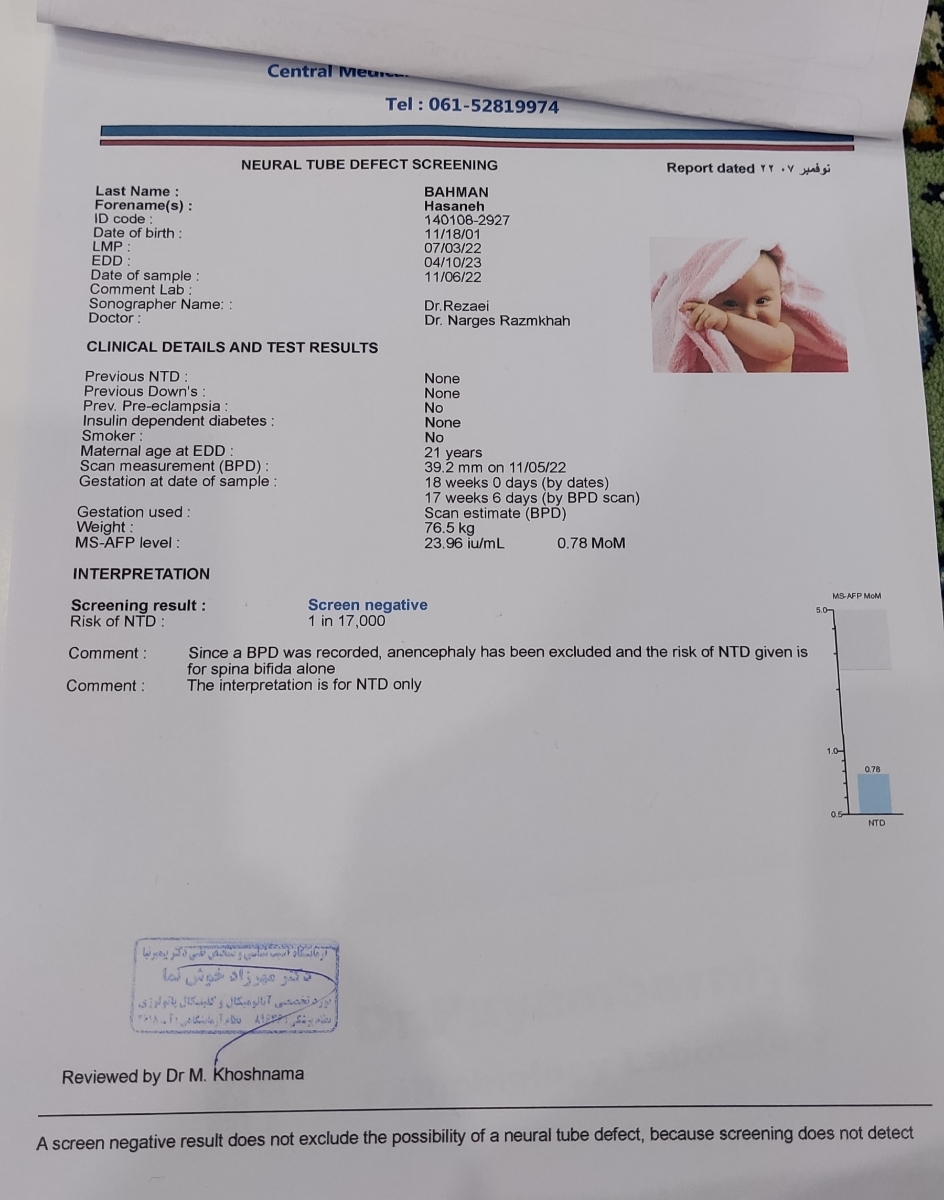 آزمایش با سونوگرافی آنومالی