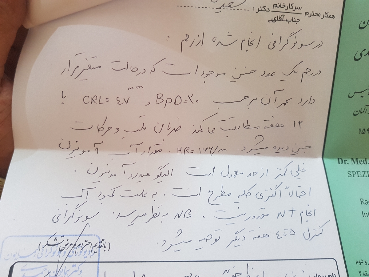 مقدور نبودن سونوی nt به خاطر کم بودن بیش از حد مایع مقدور نبودن سونوی nt به خاطر کم بودن بیش از حد مایع