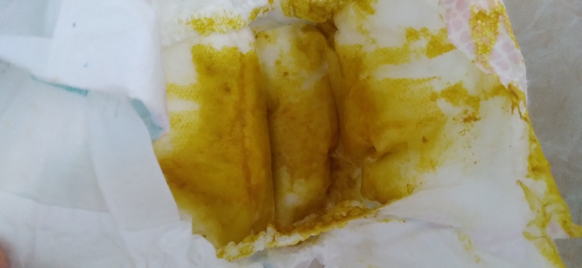 اسهال نوزاد به همراه عکس