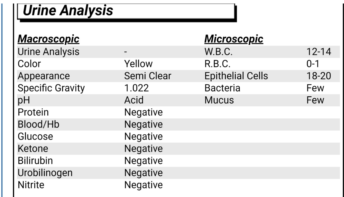 دکتر عزیز لطفا آزمایش ادرار تفسیر کنید