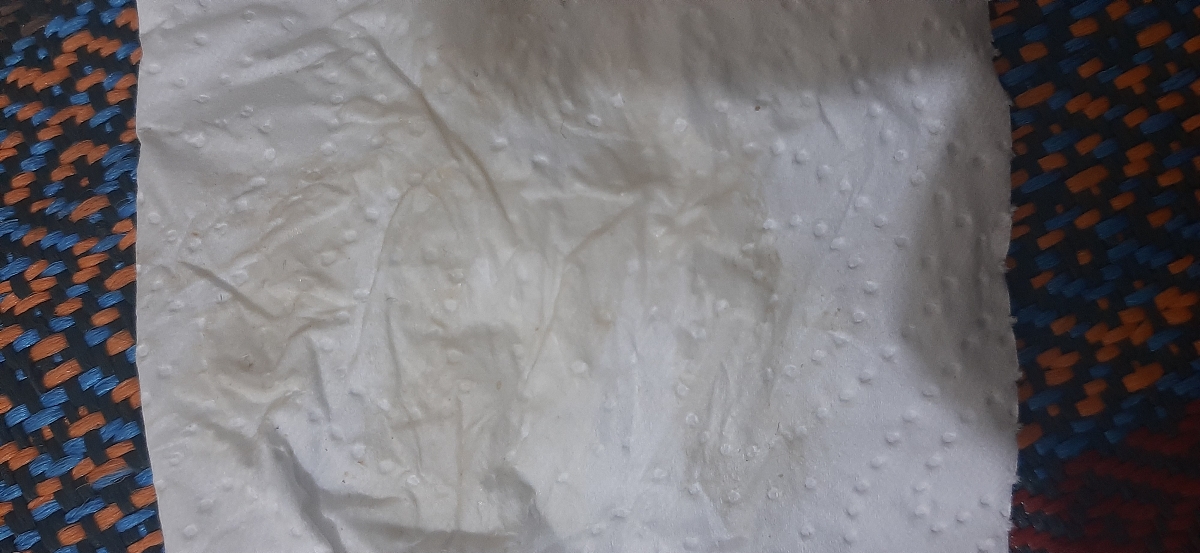 ترشحات شدید درهفته ۱۱😣 ترشحات شدید درهفته ۱۱😣