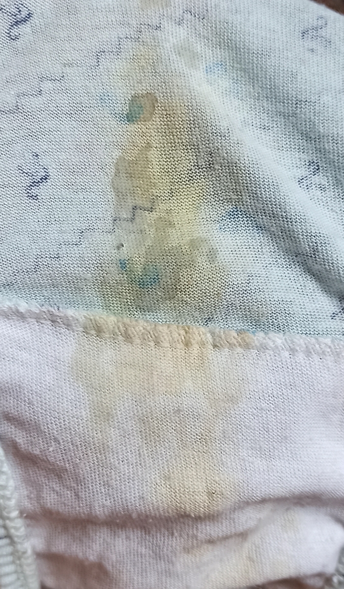 ترشح زرد رنگ .