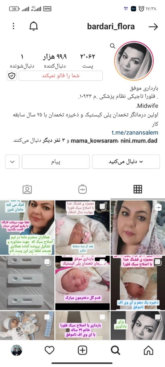 اصلاح سبک چطوریه؟ میخوام انجام بدم اصلاح سبک چطوریه؟ میخوام انجام بدم