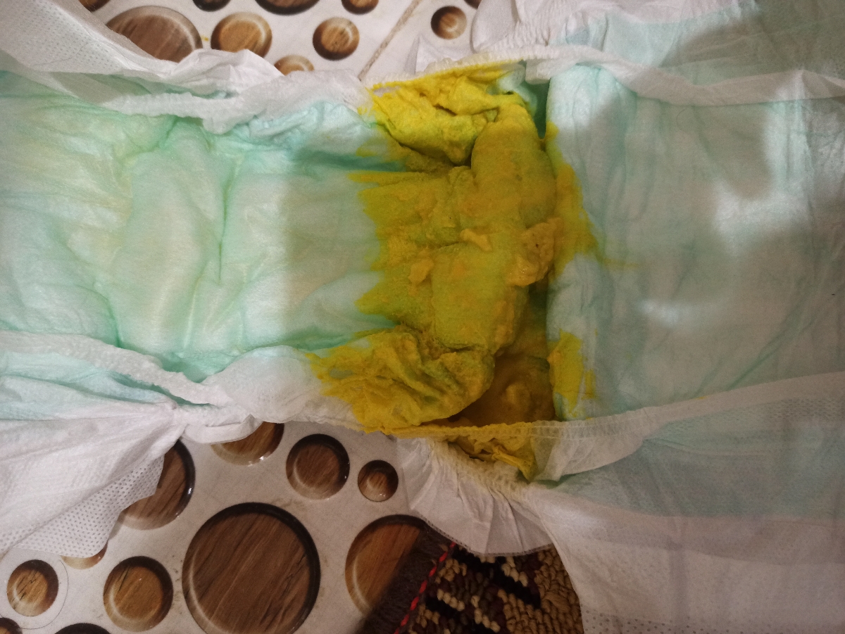 مدفوع نواز بعد تعویض شیرخشک+عکس مدفوع نواز بعد تعویض شیرخشک+عکس