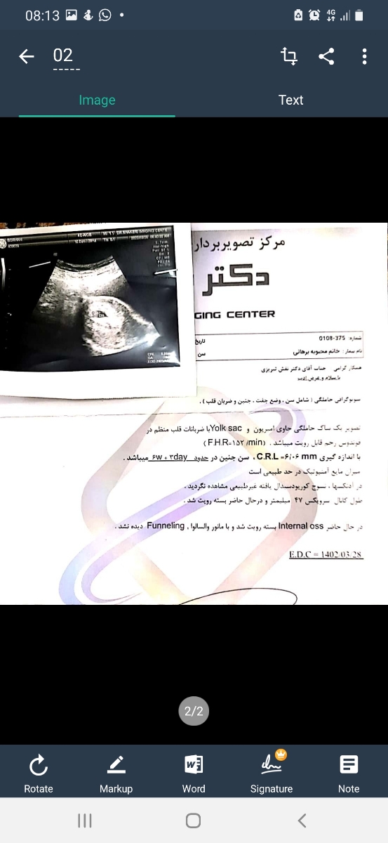 تفاوت سونوگرافی ها تفاوت سونوگرافی ها