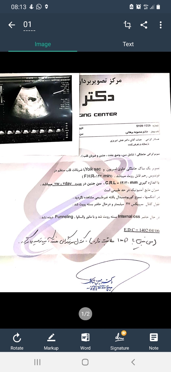 تفاوت سونوگرافی ها تفاوت سونوگرافی ها