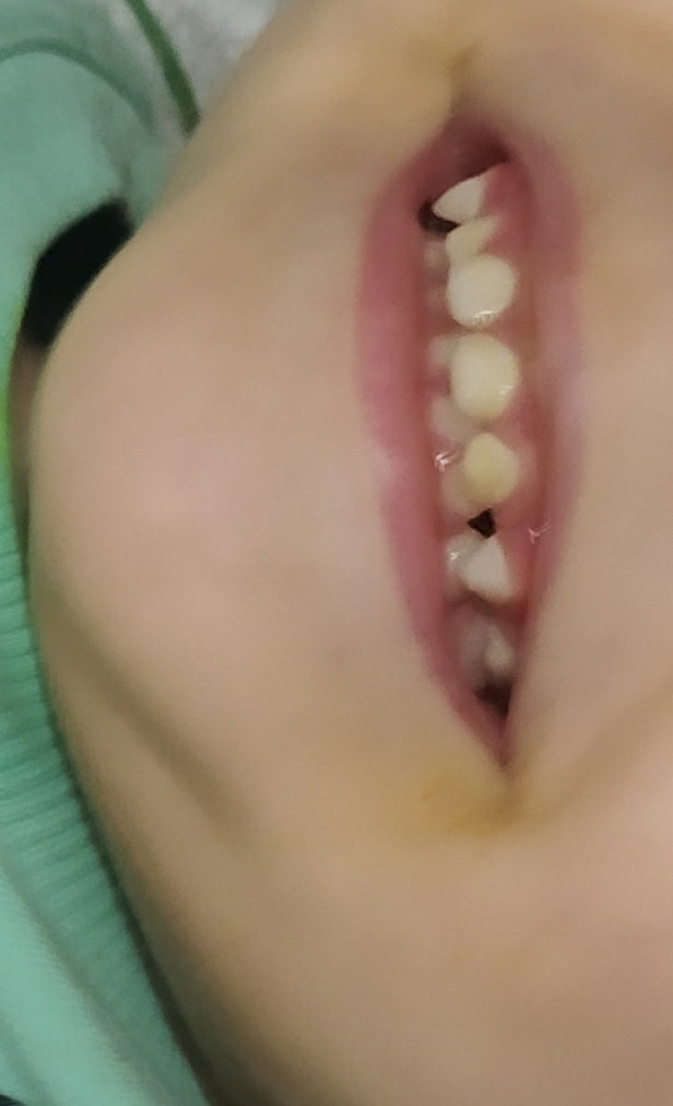 زمان مسواک زدن کودک