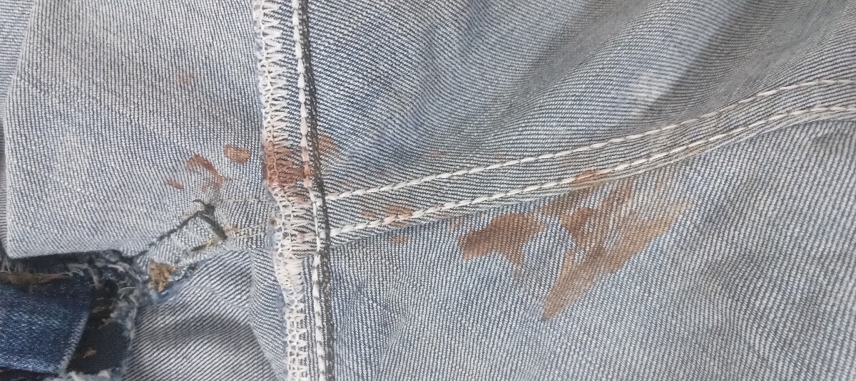 این لکه بینی من بود که دوروز داشتم و قطع شد این لکه بینی من بود که دوروز داشتم و قطع شد